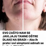 DD2